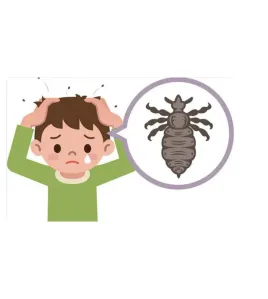 بخاخ لقتل القمل